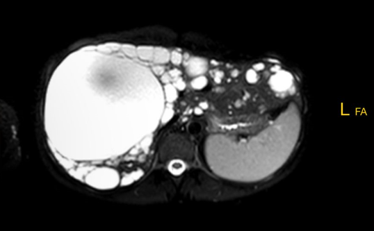 Jennifer Kürzinger – Ernährungstherapeutin für Polyzystische Lebererkrankung (PLD) & PKD in Regensburg und online
